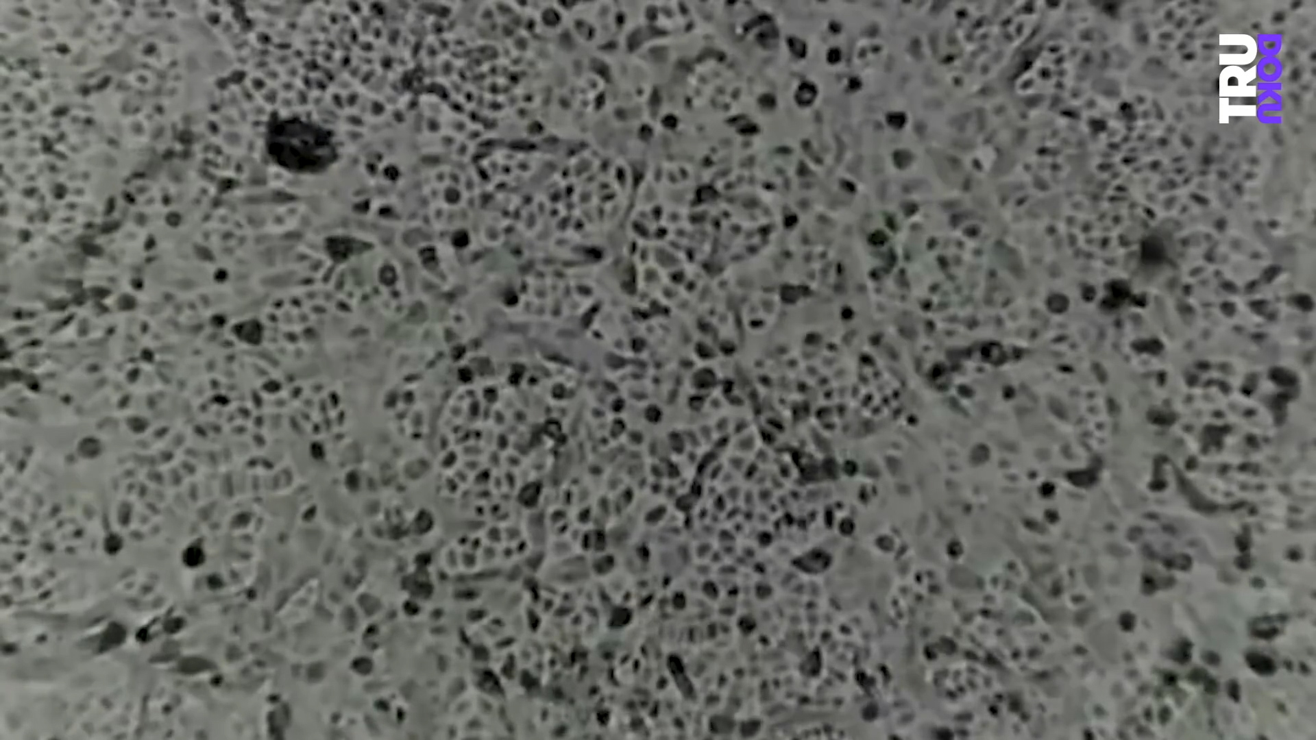 the coronavirus under a microscope